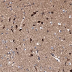 Exostosin-like 1/EXTL1 Antibody, Novus Biologicals:Antibodies:Primary Antibodies